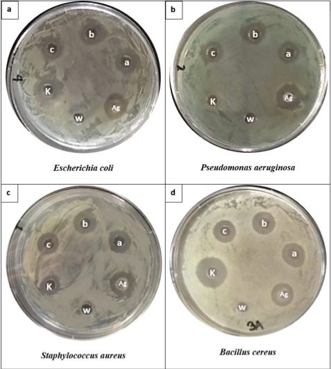 PSL%202018 vol11-no02-p75-83-Adan%20et%20al